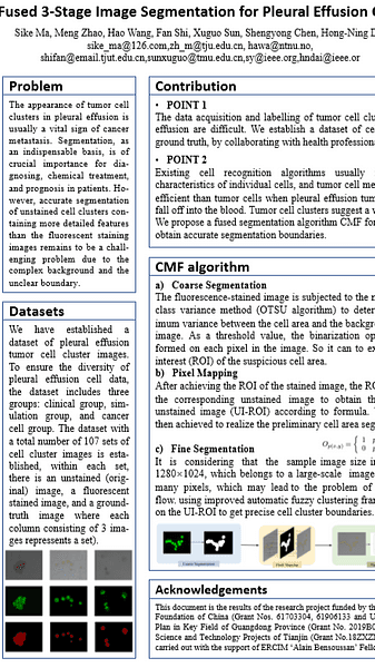 Fused 3-Stage Image Segmentation for Pleural Effusion Cell Clusters