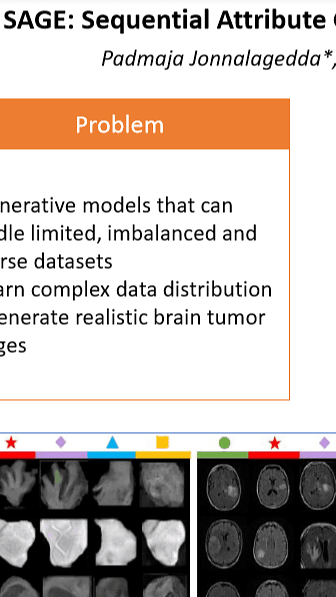 SAGE: Sequential Attribute Generator for Analyzing Glioblastomas Using Limited Dataset