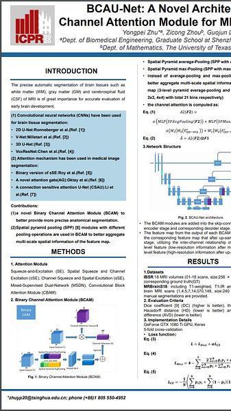 BCAU-Net: A Novel Architecture with Binary Channel Attention Module for MRI Brain Segmentation