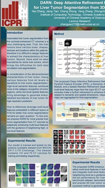 DARN: Deep Attentive Refinement Network for Liver Tumor Segmentation from 3D CT volume