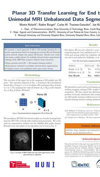 Planar 3D Transfer Learning for End to End Unimodal MRI Unbalanced Data Segmentation