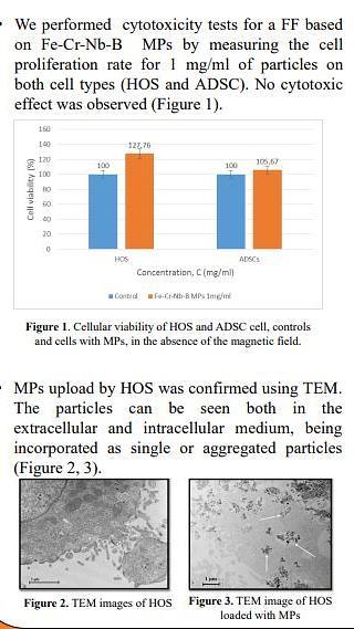  Cancer cells death induced by magneto-mechanical actuation of Fe-Cr-Nb-B magnetic particles carried by Stem cells to the cancer cells area