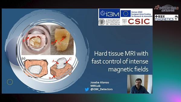  Hard Tissue Magnetic Resonance Imaging with Fast Control of Intense Magnetic Fields