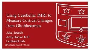 Using Cerebellar Data to Predict Cortical Changes in GBMs