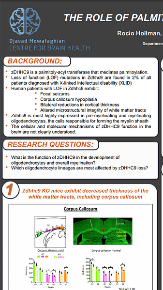 The role of palmitoylating enzyme, zDHHC9, in intellectual disability