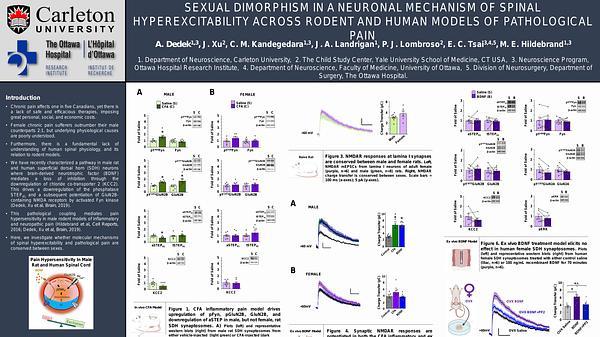 Sexual dimorphism in a neuronal mechanism of spinal hyperexcitability across rodent and human models of pathological pain