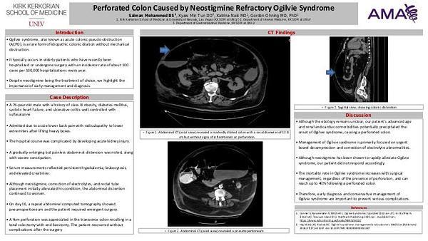 Perforated Colon Caused by Neostigmine Refractory Ogilvie Syndrome