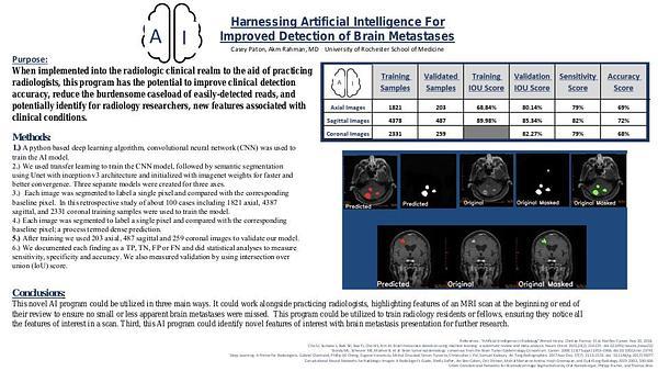 Harnessing Artificial Intelligence For Improved Detection of Brain Metastases