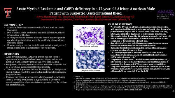 Acute Myeloid Leukemia and G6PD deficiency in a 47-year-old African American Male Patient with Suspected Gastrointestinal Bleed