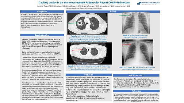 Cavitary Lesion in an Immunocompetent Patient with Recent COVID-19 infection