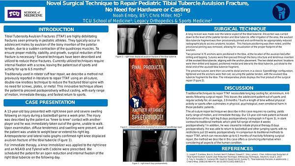 Novel Surgical Technique to Repair Pediatric Tibial Tubercle Avulsion Fracture,
No Need for Hardware or Casting