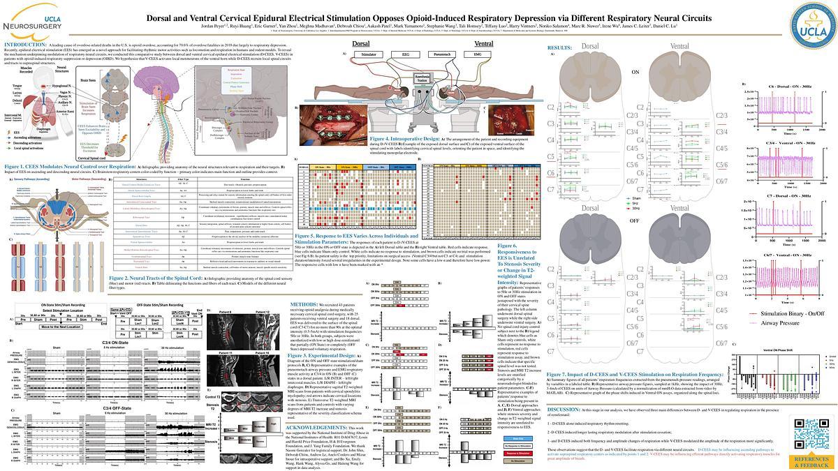 Lecture image placeholder