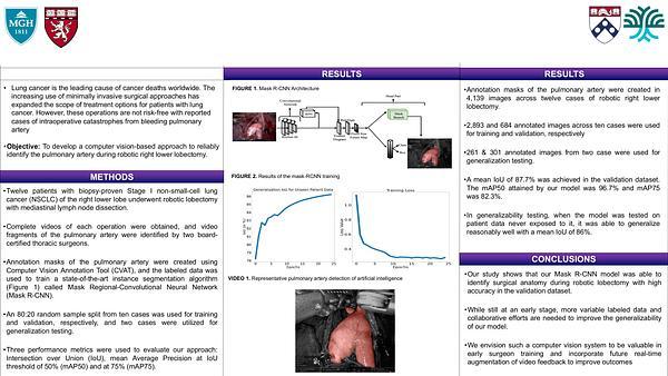 Using Artificial Intelligence for Automatic Detection of the Pulmonary Artery During Robotic Right Lower Lobectomies