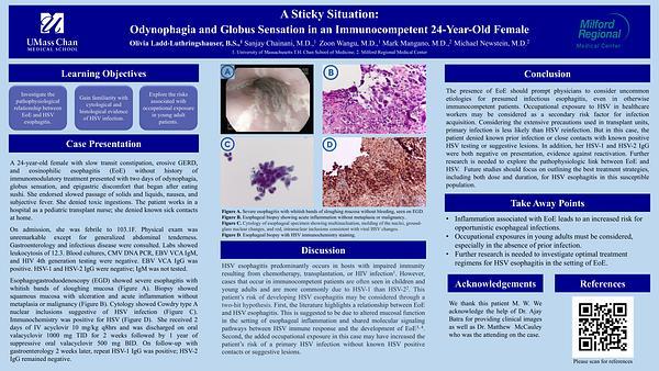 A Sticky Situation: Odynophagia and Globus Sensation in an Immunocompetent 24-Year-Old Female