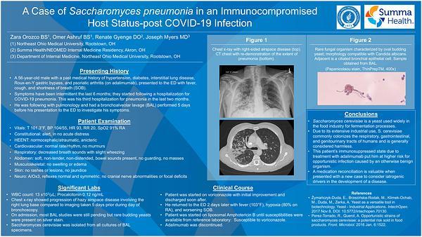 Saccharomyces cerevisiae (Baker’s Yeast) Pneumonia in an Immunocompromised Host