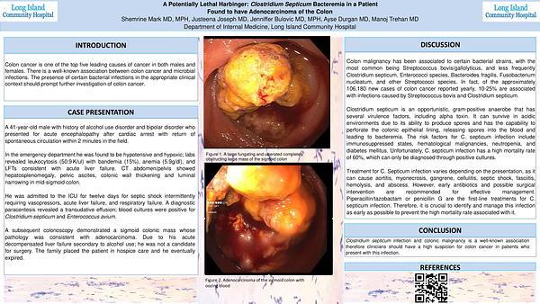 A Potentially Lethal Harbinger: Clostridium Septicum Bacteremia in a Patient Found to have Adenocarcinoma of the Colon