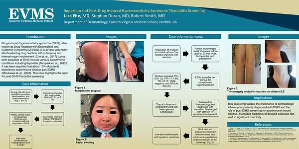 Importance of Post-Drug Induced Hypersensitivity Syndrome Thyroiditis Screening