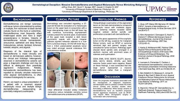 Dermatological Deception: Massive Dermatofibroma and Atypical Melanocytic Nevus Mimicking Malignancy