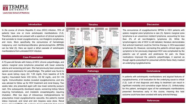 Failed to turn the tide: Chronic hepatitis C related cryoglobulinemia, lymphoma, and membranoproliferative glomerulonephritis