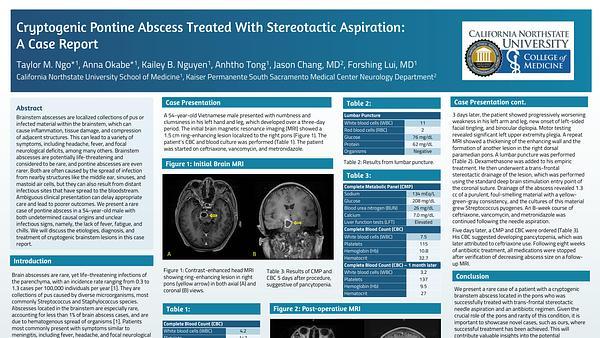 Cryptogenic Pontine Abscess Treated With Stereotactic Aspiration: A Case Report