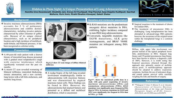 Hidden in Plain Sight: A Unique Presentation of Lung Adenocarcinoma