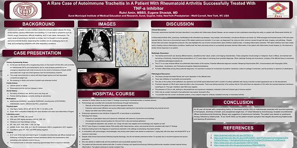 A Rare Case of Autoimmune Tracheitis In A Patient With Rheumatoid Arthritis Successfully Treated With TNF-a Inhibitor