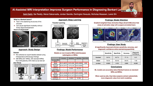 AI-Assisted MRI Interpretation Improves Surgeon Performance in Diagnosing Bankart Lesions