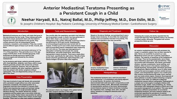 Anterior Mediastinal Teratoma Presenting as a Persistent Cough in a Child