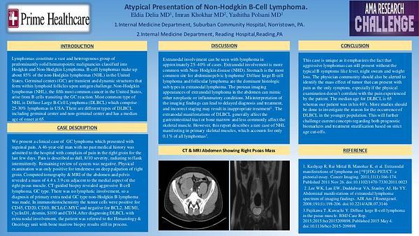 Atypical Presentation Of Non-Hodgkin B-Cell Lymphoma.
