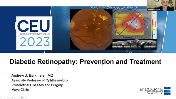 Diabetic Retinopathy: Prevention and Treatment